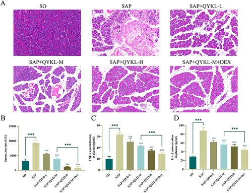 Figure 7 QYKL and DEX alleviated pancreatic injury and inflammation in the SAP rats. (A) H&E staining to evaluate the pathological damage of pancreatic tissue in rats (Scale bar = 100 μm). (B) Determination of serum amylase levels. Determination of serum TNF-α (C) and IL-1β (D) levels. Data were representative images of each group of rats in at least three independent experiments or expressed as mean±SD. *** indicates a P value less than 0.001. ### indicates a P value less than 0.001 compared to the SAP group.