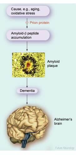 Figure 1. Protective role for PrPC in Alzheimer‘s disease.