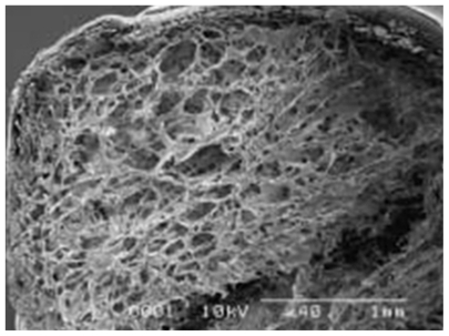 Figure 6 Electron micrograph of a poly glycolic acid (PGA)-collagen composite nerve conduit filled with collagen sponge. The PGA-collagen composite conduit is filled with a three-dimensional sponge matrix.