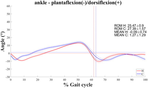 Figure 2. Right ankle planta-dorsiflexion.