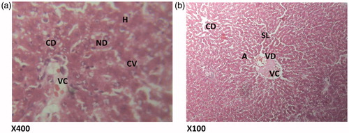Figure 3. (Paracetamol only) Histologic sections through the liver at magnification ×400 (a) and ×100 (b) showing area radiating hepatocytes, the sinusoidal layer and prominent cellular degeneration and proliferation of inflammatory cells with vascular congestion and degeneration. H – hepatocytes; CD – cellular degeneration; ND – nuclear degeneration; CV – cytoplasmic vacuolation; VC – vascular congestion; SL – sinusoidal layer; A – normal architecture; VD – vascular degeneration.