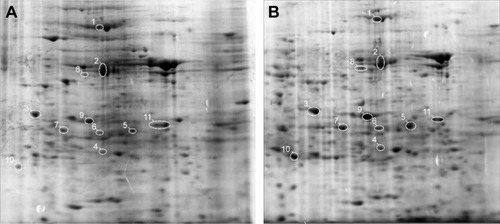 Figure 1 Representative two-dimensional electrophoretic images of human epithelial ovarian cancer SKOV3 cells untreated (A) and treated with CM from O-ADSC (B).