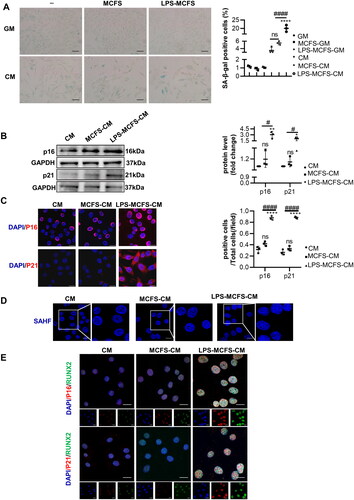 Figure 4. LPS-induced macrophages promote VSMCs senescence. (A) The senescence of VSMCs was assessed by SA-β-gal staining and quantification under GM and CM conditions. n = 3. Scale bar, 50 μm. (B) Representative Western blot images of senescent protein p16 and p21 in VSMCs treated with CM, MCFS-CM, and LPS-MCFS-CM. n = 3. (C) Immunofluorescence staining was performed to investigate the expression of p16 and p21 in VSMCs treated with CM, MCFS-CM, and LPS-MCFS-CM. Scale bar, 20 μm. (D) Senescence-associated heterochromatin foci (SAHF) were detected in VSMCs treated with CM, MCFS-CM, and LPS-MCFS-CM, indicating the presence of heterochromatin aggregation in the cell nucleus. Scale bar 20 μm. (E) Immunofluorescence double staining of RUNX2 with p16 and p21 respectively. Scale bar, 20 μm. Data are presented as mean ± SD, one-way ANOVA (A, B and C), *p < 0.05, **p < 0.01, ****p < 0.0001 versus CM, # p < 0.05, #### p < 0.0001 versus MCFS-CM.