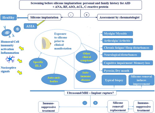 Figure 1. Autoimmune/auto-inflammatory syndrome induced by adjuvant (ASIA) in women with breast silicone implants – suggested screening and therapeutic approach (criteria according to Schoenfeld and Agmon-Levin, 2011 [1]). AID – autoimmune disturbances; ANA – anti-nuclear antibodies; RF- rheumatoid factor; ASO- antistreptolysin-O titer; ACL – anticardiolipin antibodies; MRI –magnetic resonance imaging; + yes; − no.