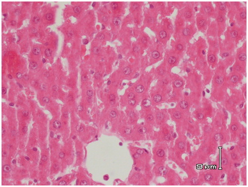 Figure 8. Paraffin sections stained by haematoxylin and eosin (H&E) for histopathological examination of liver tissues of rats treated with APAP (500 mg/kg) and RA (100 mg/kg). RA 100 mg/kg restored the normal architecture of the hepatic lobules and the hepatocytes.