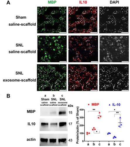 Figure 7 Implantation of stem cell exosome-scaffold on ligated nerves enhances myelin basic protein (MBP) and interleukin-10 (IL-10) expression in injured nerves of L5/6 spinal nerve ligation (SNL) rats on day 21 after surgery. (A) Representative immunofluorescent image showing the expression of MBP, IL-10 and DAPI (white spots, nuclear staining) in ipsilateral L5 spinal nerve. Scale bar: 50 μm. (B) Left: representative Western blots of MBP, IL-10 and control protein actin in ipsilateral L5/6 spinal nerves. Right: summarized graph depicting protein levels presented as raw data points and Mean ± SD, taking Sham/saline-scaffold group as 100% (*P<0.05, **P<0.01, Kruskal–Wallis test followed by Dunn’s multiple pairwise comparisons test, n=3 in each group).