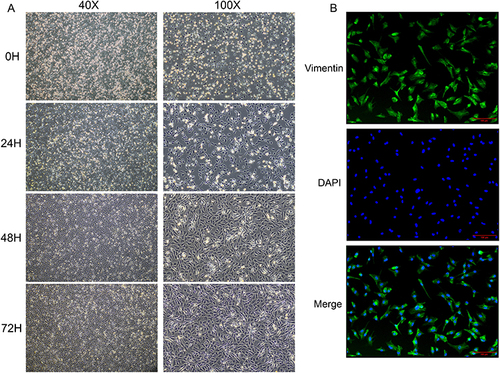 Figure 1 Identification of primary cardiac fibroblasts. (A) The morphology and confluency of cardiac fibroblasts at each point (0H, 24H, 48H, 72H are the time after differential adhesion). (B) The purity of cardiac fibroblasts identified by immunofluorescence.