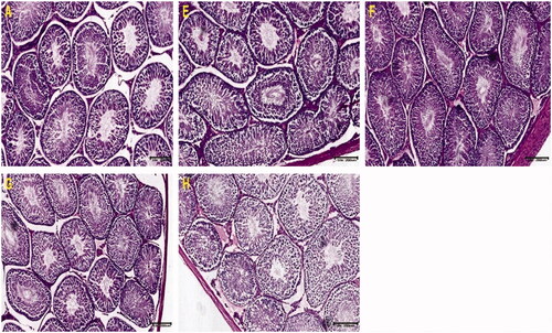 Figure 3. Photomicrograph of testicular sections stained with Masson’s Trichrome for connective tissue. Note the extensive, intense staining of seminiferous tubular Basement membrane and interstitial spaces alongside hypoplasia in sections E, F and H compared with control (A). Nuclei can be seen as dark red or black structures within the tubular cell population, while fibrous elements are stained light blue.