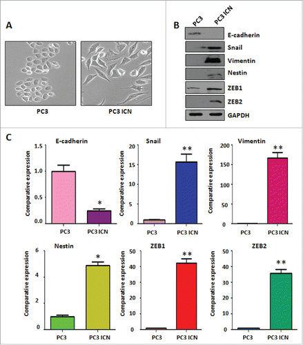 Figure 4. PC-3 ICN cells have the morphologic changes and EMT feature. (A) The PC-3 and PC-3 ICN cells were photographed under the microscope. (B) Western blotting was conducted to measure the protein levels of EMT markers in PC-3 ICN cells. (C) Real-time RT-PCR was performed to detect the mRNA levels of EMT markers in prostate cancer cells. *P<0.05; **P<0.01 vs PC-3 cells.