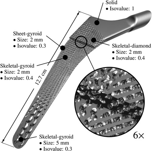 Figure 9. ASLI generated 3D-model of a femoral implant with a graded lattice where unit cell type, size and isovalue are varied. The top half of the lower section of the implant has been hidden to also show the internal structure. The transition between three different lattice types can be seen to happen smoothly in the close-up.
