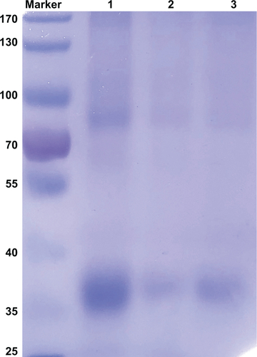 Figure S3 Loading efficiency of the complexes.Notes: Sodium dodecyl sulfate polyacrylamide gel electrophoresis of unabsorbed Ova in the supernatants: lane 1, Ova; lane 2, Ova/CS/O-HTCC; lane 3, Ova/O-HTCC.Abbreviations: CS, curdlan sulfate; O-HTCC, O-(2-hydroxyl)propyl-3-trimethyl ammonium chitosan chloride; Ova, ovalbumin.