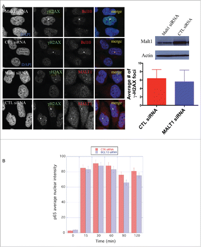 Figure 3. MALT1 is dispensable for γ-H2AX cryptic foci formation. (A) Immunodetection of BCL10 and γ-H2AX in T47D cells transfected with control siRNA (CTL siRNA), or MALT1 siRNA (MALT1 siRNA). Quantification of the average number of cryptic γ-H2AX foci per cells is shown on the right. MALT1 knocking down efficiency was shown by an immunoblot on the top. (B) The effect of BCL10 knock down on NFκB activation in response to DNA damage. NFκB activation was measured by the translocation of p65 into the nucleus in response to DNA damage with or without BCL10 depletion. Quantification of the p65 nuclear translocation was measured.