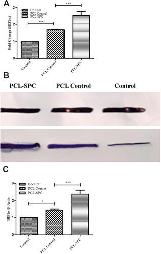 Figure 4 Molecular analysis of Hypoxia-inducible factor-1 (HIF-1α). (A) Relative mRNA expression analysis of HIF-1α gene in PCL-SPC; PCL Control and Control groups by q-PCR. (B-C) Protein expression analysis of HIF-1α protein in PCL-SPC; PCL Control and Control groups by Western blotting. Data are expressed as mean±SD. *P≤0.05; ***P≤0.001.