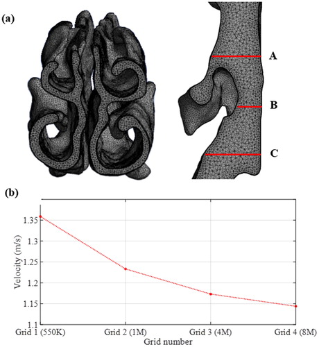 Figure A1. (a) Quality of computational mesh at the nasal cavity and upper airway and (b) mesh independency study.