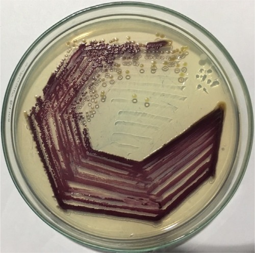 Figure 2 Chromobacterium violaceum growing on nutrient agar.