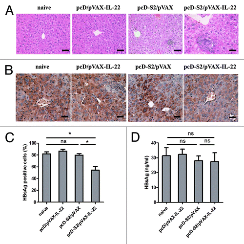 Figure 7. Histopathology of liver and immunochemical staining in HBsAg-transgenic mice; (A) Livers from each group were isolated on day 14 after the final immunization and fixed, sectioned, and then stained with H&E. Bar = 50 μm; (B) Specific immunostaining of HBsAg on day 14 after final immunization. Bar = 50 μm; (C) The percentage of HBsAg-positive hepatocytes was determined by light microscopy; (D) The concentration of HBsAg in sera on day 14 after final immunization was detected by ELISA. There were four mice in each group (* p < 0.05; ns, p > 0.05).