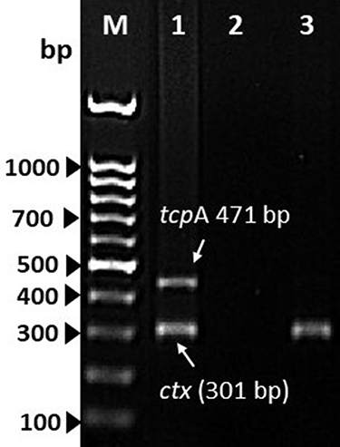 Figure 2 Multiplex-PCR analysis for ctxA and tcpA genes. Lane M, 100 bp DNA ladder; lane 1, V. cholerae O1 Ogawa-Classical NIH41 (positive control for ctxA and tcpA gene); lane 2, negative control; lane 3, V. cholerae non-O1/O139 strain isolated from urine specimen.