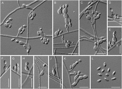 Figure 18. Psychrophila lagodekhiensis (ex-type CBS 122314). A–K. Phialides with conidia (MLA slide culture, 13 d). L. Conidia (MLA slide culture, 13 d). Bars = 10 μm.