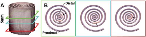 Figure 1 Methodology for tissue preparation and histology. Swiss Roll: (A) The entire colon is cut down the length, spread out and wrapped starting with the distal end (rectum) and rolled ending with the most proximal end on the outside. (B) The tissue was processed through paraffin, sectioned at 5µM and stained with H&E; arrows indicate areas of focal damage in the DSS model.