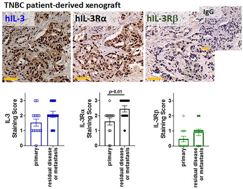 Figure 3. Human TNBC PDXs – IL-3/IL-3R IHC scores – primary and metastasis.Representative IHC of IL-3, IL-3Rα and IL-3Rβ protein expression by human TNBC PDXs. DAB staining (brown) and hematoxylin counterstain (blue). Staining intensity scored for primary (n = 13 tumors, open shapes) or residual disease/metastasis sections (n = 11 tumors, closed shapes) with results shown as individual scores for the 24 different tumors. A two-tailed Mann-Whitney test compared the primary and residual/metastatic lesions with p < 0.05 considered significant. Yellow scale bar = 50µm.