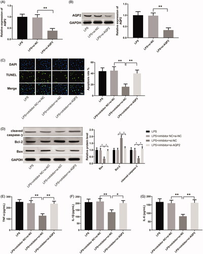 Figure 5. miR-34b-5p mediates LPS-induced apoptosis and inflammatory response in HK-2 cells by targeting AQP2. Notes: qRT-PCR (A) and Western blotting (B) detected the expression of AQP2 in LPS-induced HK-2 cells transfected with si-AQP2. After transfection of miR-34b-5p inhibitor + si-NC or miR-34b-5p inhibitor + si-AQP2 in LPS-induced HK-2 cells, (C) TUNEL staining assessed the cell apoptosis; (D) Western blotting measured the expressions of Bax, Bcl-2, and cleaved caspase-3 in HK-2 cells; ELISA measured the levels of TNF-α (E), IL-1β (F), and IL-6 (G) in the cell supernatant; scale bar = 50 μm; *p < 0.05, **p < 0.01, compared to LPS + inhibitor NC + si-NC group or LPS + inhibitor + si-NC group. LPS: lipopolysaccharide.