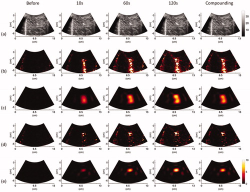 Figure 4. Typical (a) B-mode, (b) |CBE|, (c) |CBE¯|, (d) CBE|η>0, and (e) CBE¯|η>0 images obtained at various time points and under using temporal compounding (ATL = 0.5 cm). During RFA, areas that were hyperechoic due to the formation of gas bubbles appeared in B-mode images, causing the image brightness to slightly increase in correspondence with the ablation time. In images, the shadowing effect can be observed in the area where the electrode was positioned.