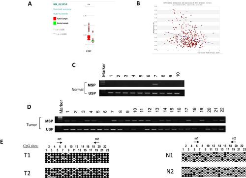 Figure 3 Methylation level of SOX17 was higher in primary RCC tissues than in normal kidney tissues. (A) SOX17 methylation was higher in RCC tissues than in normal kidney tissues, as obtained from PubMed Database, **p<0.005. (B) Methylation and expression of SOX17 were negatively correlated in RCC samples. One red circle represents one clinical sample. (C) SOX17 methylation status in adjacent non-malignant kidney tissues, determined using MSP. (D) SOX17 methylation in RCC tissues, determined using MSP. (E) Methylation of SOX17 promoter in human tissues was shown using BGS.