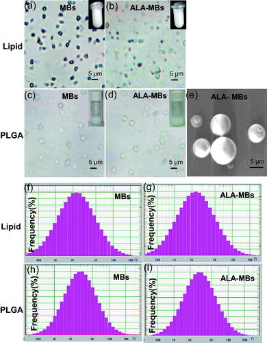 Figure 1. Confocal microscope image of (a) lipid MBs, (b) ALA-lipid MBs, (c) PLGA MBs and (d) ALA-PLGA MBs. (e) SEM images of ALA-PLGA MBs. Particle size distribution of (f) lipid MBs, (g) ALA-lipid MBs, (h) PLGA MBs and (i) ALA-PLGA MBs.