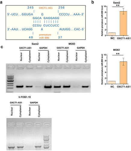 Figure 4. The effects of OXCT1-AS1 on premature and mature miR-886 expression Saos2, MG63 and hFOB 1.19 cells were transfected by OXCT1-AS1 expression vector or si-OXCT1-AS1 (a). The effects of OXCT1-AS1 on the expression of premature (b) and mature (c) miR-886 were analyzed with RT-qPCRs. ** p < 0.01.