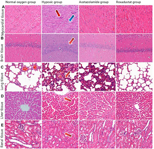 Figure 3 Pathological results of myocardial (A), brain (B), lung (C), liver (D), and renal (E) tissues in rats (HE, 400.0×).