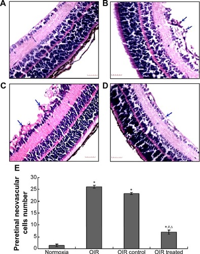 Figure 2 Effect of CCN1 siRNA on pre-RNV in mice with OIR.