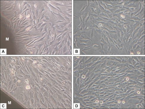 Figure 3 The cellular morphology and proliferation of BMSCs cultured with nHA/PA66 membrane and BMSCs (control) under inverted phase contrast microscope (magnification:200×) at day 4 (A, B) and day 7 (C, D). M stands for nHA/PA66 membrane.