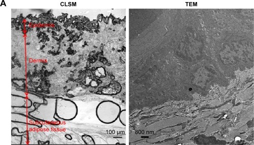 Figure 7 The penetration ability of gold nanoparticle in the skin tissue observed by CLSM and TEM.Notes: (A) CLSM and TEM images of untreated skin depicting the multiple layer structure. (B) CLSM images of different skin layers and TEM image of the subcutaneous adipose tissue 24 hours after topical application of FITC-labeled pristine GNS, GNS–PEG, and GNS–PEG–OAm. The red arrows indicate the presence of gold nanoparticle. CLSM magnification: 60×; TEM magnification: 5,000×.Abbreviations: CLSM, confocal laser scanning microscopy; FITC, fluorescein isothiocyanate; GNS, gold nanoparticles; OAm, oleylamine; PEG, poly(ethylene glycol); TEM, transmission electron microscopy.