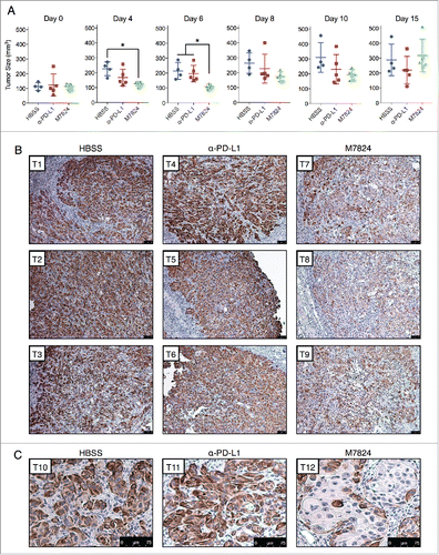 Figure 7. M7824 reverts TGF-β1-induced mesenchymal features in vivo. (A) Measurements of tumor size for the HCC4006 xenografts at various time points. *, p < 0.05. (B) Representative IHC staining for vimentin expression from 3 tumors per treatment group. Scale bar = 75 μm. (C) Magnified view of representative IHC staining for vimentin expression from a fourth tumor from each treatment group. Scale bar = 75 μm.