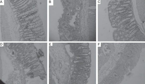 Figure 1.  Histopathological observations of colon tissue after the treatment with fractions of crude methanol extract of C. dichotoma bark. A = Standard; B = n-Hexane fraction; C = Methanol fraction; D = Crude methanol extract; E = Ethyl acetate fraction, F = Control (5% acetic acid).