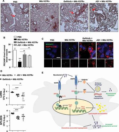 Figure 9. EGFR-BRD4 aids in mycobacterial survival. (A and B) Immunohistochemical analysis of PECAM1 expression in the lung sections of the indicated groups of mice and the respective quantification. PECAM1-lined blood vessels with blood-filled lumen are close representatives of normal vasculature (n = 3 mice in each group). (C) Lung cryosections from the indicated groups of mice were analyzed for autophagy and LD accumulation by MAP1LC3B immunostaining and BODIPY 493/503 staining, respectively (n = 3 mice in each group). (D) The indicated groups of mice were assessed for Mtb H37Rv CFU in the lungs (D, top panel) and spleen (D, bottom panel) (n = 8 mice in each group). (E) Model: Mycobacteria coopts EGFR-BRD4 axis to promote aberrant angiogenesis and suppress lipophagy to thrive within the host milieu. **, p < 0.01; *** p < 0.001; **** p < 0.0001 (one-way ANOVA in B, D; GraphPad Prism 9.0).