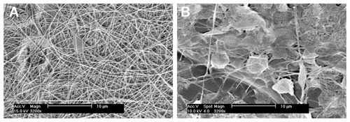 Figure 10 Morphology of nanofibrous PLGA scaffolds created by electrospinning of PLGA diluted in methylene chloride and dimethyl formamide (2:3) at a concentration of 2.3 wt% (A) or 2.0 wt% (B).Note: XL30CP scanning electron microscope (Phillips Elektron Optics GmbH, Kassel, Germany), objective magnification 3200×, bar 10 μm.Abbreviation: PLGA, copolymer of L-lactide and glycolide.