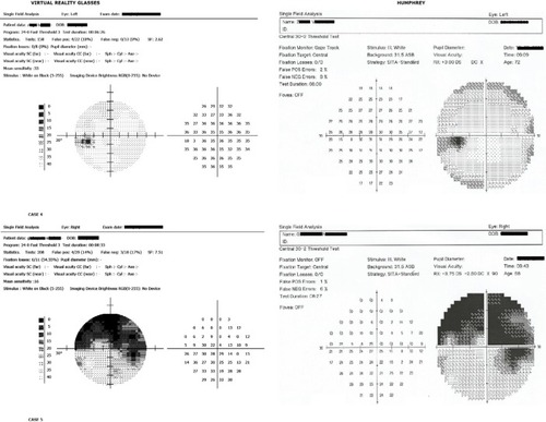 Figure 11 Results, eye 4–6.