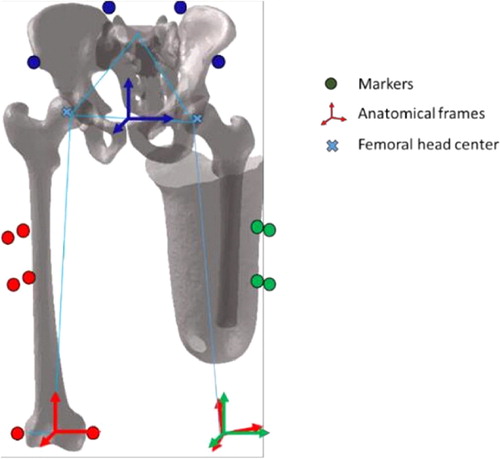 Figure 1. Illustration of the residual femur, socket and pelvis and their anatomical frames.