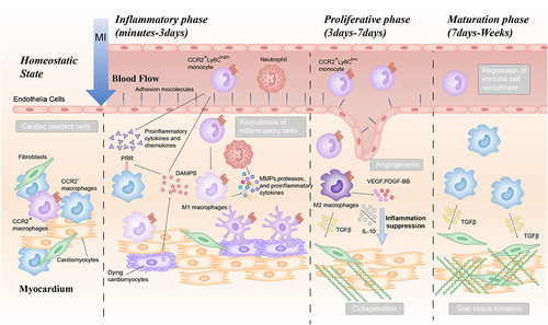 Figure 1 Immune Cell Dynamics in Myocardial Infarction.