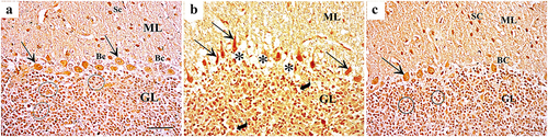 Figure 3. Silver impregnation of cerebellar sections showing (a): the control group shows more polymorphic neuronal cells in the molecular layer (ML) in the form of outer stellate cells (Sc) and inner basket cells (Bc). The Purkinje cells (arrow) are large, pyriform shaped with vesicular nuclei. The granular layer (GL) contains plenty of granule cells arranged in rosettes or cords (circles). (b): Group II shows marked decreased cellularity in molecular layer (ML), Purkinje cells are darkly stained with abnormal shape (arrow), and vacuolated neuropil (asterisks). The granular layer (GL) shows peri-neuronal spaces (curved arrow) around dark stained granule cells. (c): Group III shows normal shaped molecular layer (ML) containing stellate cells (Sc) and basket cells (Bc). The Purkinje cells (arrow) are pyriform shaped with vesicular nuclei. The granular layer (GL) contains plenty of granule cells arranged in rosettes (circles) (Silver impregnation×400; Scale bar = 30 µm).