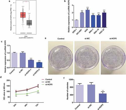 Figure 1. LncRNA HCP5 silencing inhibits the proliferation of AGS cells. (a) The expression level of HCP5 in GC tumor samples and normal samples predicted by GEPIA website. (b,c) The expression of HCP5 was detected by RT-qPCR. (d) The survival rate of cells was evaluated with cell viability assay. (e) The cell proliferation was assessed by colony formation assay, and quantification (f). Error bars represent the mean ± SEM from three independent experiments. **P< 0.01, ***P< 0.001 vs. Control