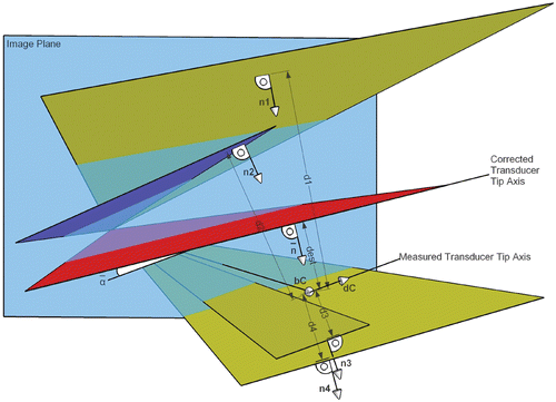 Figure 4. Back-projection of four segmented lines, which generates four planes and their corresponding normals n1, n2, n3, and n4 (plane coloring according to Figure 2). For each plane j, its distance dj to bC and angle αj to dC are computed. We suppose that all four planes satisfy |αj| < 5° and |dj| < 30 mm. Because d1 is the maximum positive distance from bC, and d4 the maximum negative distance from bC, we can set dposmax = d1 and dnegmax = d4. If |dposmax − dnegmax| = |d1 − d4| stays within 10 ± 2 mm, we continue our computations. For all distances i unequal dposmax and dnegmax, we check whether dposmax − di < 2 mm or di − dnegmax < 2 mm. All planes not satisfying this criterion are excluded from further computations, as for plane 2 (blue). Using the remaining three yellow planes, a mean plane (red) defined by and is determined. The transducer tip axis can finally be translated along for dest = 0.5(d1 + d4) mm and rotated by around . [Color version available online.]