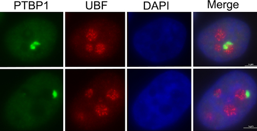Figure 1. Immunofluorescence images showing PNCs detected by a PTBP1-specific antibody (green) and nucleoli labeled with an anti-UBF antibody (red). Nuclei are visualized by DAPI staining (blue) scale bar, 5 μm.