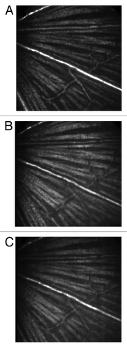 Figure 2. Reflectance images taken with (A) 638 nm, (B) 532 nm and (C) 491 nm lasers demonstrate that the three lasers of the SLO share a common optical section in the retina. Field of view was 15° (approximately 400 µm).