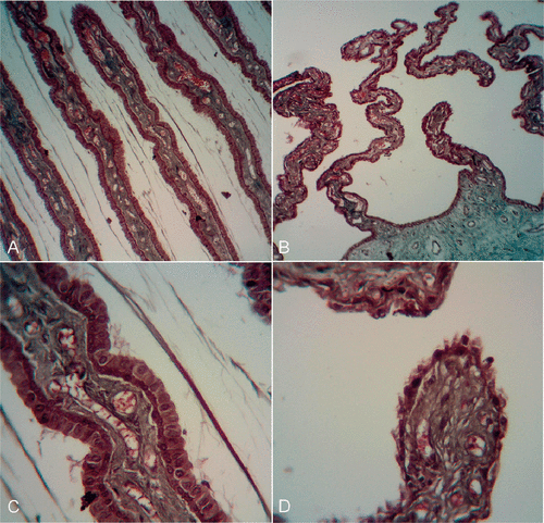 Figure 4. Histological sections at low (top) and high (low) magnification showing the difference between the intact (A and C) and treated (B and D) ciliary body: loss of the bilayered epithelium responsible for the production of aqueous humor (fluid filling the eye).