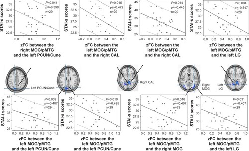 Figure 6 Correlations between the connectivity coefficients and the STAI-s and STAI-t scores in the CID patients.