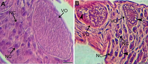 Figure 1. Hematoxylin and eosin staining of paraffin sections of an Erpobdella johanssoni ovary. A, Histological sections of the ovarian cord from the control group showing normal architecture: nurse cells (NC) and vitellogenic oocytes (VO). B, Ovary from treated leech revealed degeneration shrinkage of nurse cells (NC) and vitellogenic oocytes (VO), and extensive vacuolization of their ooplasm (arrowheads). Scale bars = 20 μm.