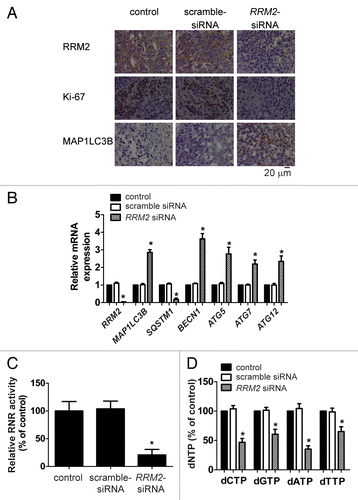 Figure 6. Treatment of RRM2 siRNA induced autophagy in human cancers grafted in NOD-SCID mice. (A) RRM2 siRNA induces autophagy in vivo. RRM2, MKI67, and MAP1LC3B levels in xenografted tumor sections of vehicle-, scrambled siRNA-, and RRM2 siRNA-treated mice were visualized by immunohistochemical analyses. (B) Knockdown of RRM2 upregulates selected ATG gene transcript abundance in xenograft tumors. Selected mRNA expression levels of RRM2, MAP1LC3B, SQSTM1, ATG5, BECN1, ATG7, and ATG12 in xenografted tumor tissues of vehicle-, scrambled siRNA-, and RRM2 siRNA-treated mice were assayed by qRT-PCR analyses. (C) Decreased RNR activity in tumor xenografts treated with RRM2 siRNA. RNR activity in respective xenografted tumor tissues of vehicle-, scrambled siRNA-, and siRNA-treated mouse was assayed. (D) Decreased dNTP pool levels in tumor xenografts treated with RRM2 siRNA. Levels of dNTPs in tumor tissues of vehicle-, scrambled siRNA-, and RRM2 siRNA-treated mice were analyzed and compared. Data of column represents means ± SD of 3 independent experiments (*P < 0.05 vs. vehicle-treated group).
