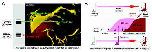 Figure 1. Elevated CSF levels of total tau and phosphotau in early AD are better explained by secretion of misprocessed tau from neurons and glia rather than a consequence of massive neuronal death. (A) CSF-tau in AD consists largely of 1) N-terminal fragments between 20–35kD apparent molecular weight with a variable admixture of higher MW species that appear to represent near full length tau. These match the secreted tau species seen in both in situ and cell culture models of tau secretion. The image at right shows an identified neuron (ABC) in the lamprey brain expressing 4R0N human tau with the P301L tauopathy mutation after 20 d of expression immunolabeled with tau12 (N-terminal mAb – red channel) and the GFP tag (green channel). This image illustrates the multiple possible secretion routes for tau that ultimately accumulates in the CSF. The “diffuse” tau described in the lamprey model consists largely of N-terminal fragments that lack the MTBR, whereas the “focal” route requires the presence of the MTBR. Both secretion routes in the lamprey model either introduce tau to the interior surfaces of the IVth ventricle (periventricular tau) or cross it entirely. (B) The respective time courses of neuronal death and CSF-tau elevation in AD are inconsistent with postmortem passive leakage of tau into the CSF, with the highest levels of CSF-tau occurring well before the onset of widespread cerebral occurrence of neurofibrillary degeneration in the so-called isocortical stages (Braak 5–6) of AD, and failing to increase with disease severity.